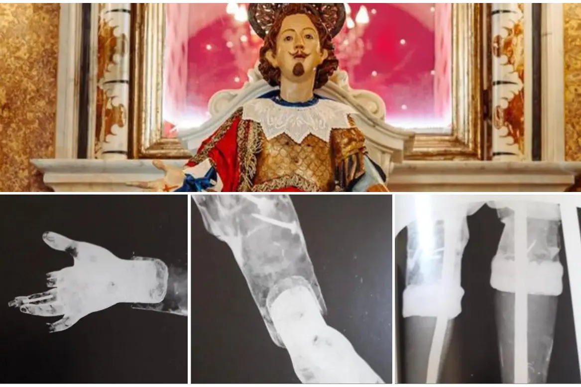 La statua di Sant'Efisio e le radiografie che evidenziano le fratture