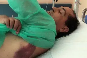 Tommaso Argiolas in ospedale dopo il ricovero