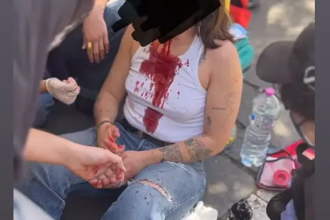 La manifestante ferita (frame Instagram)