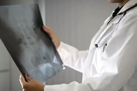 Tumore alla vescica in fase avanzata, nuova terapia anche in Italia