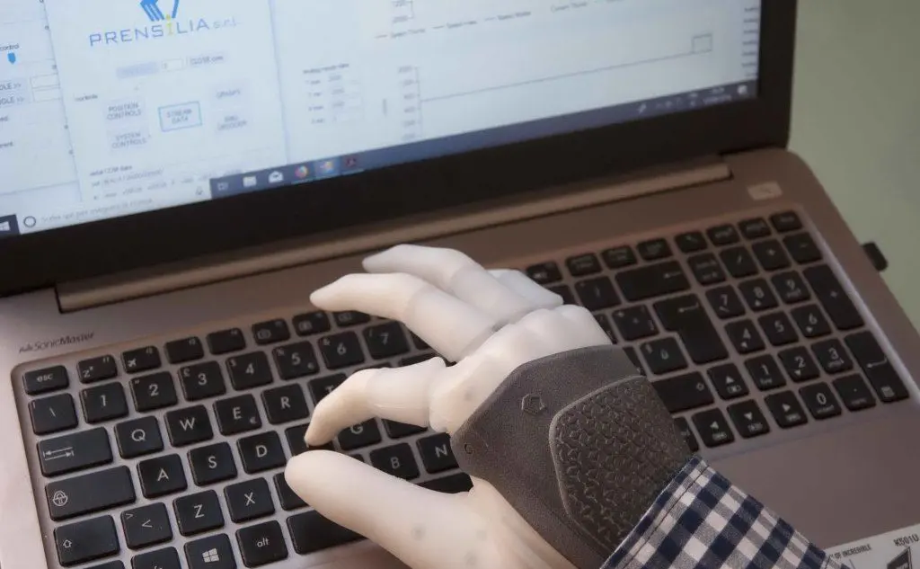 La nuova mano consentirà anche di percepire gli stimoli sensoriali (foto Ansa)