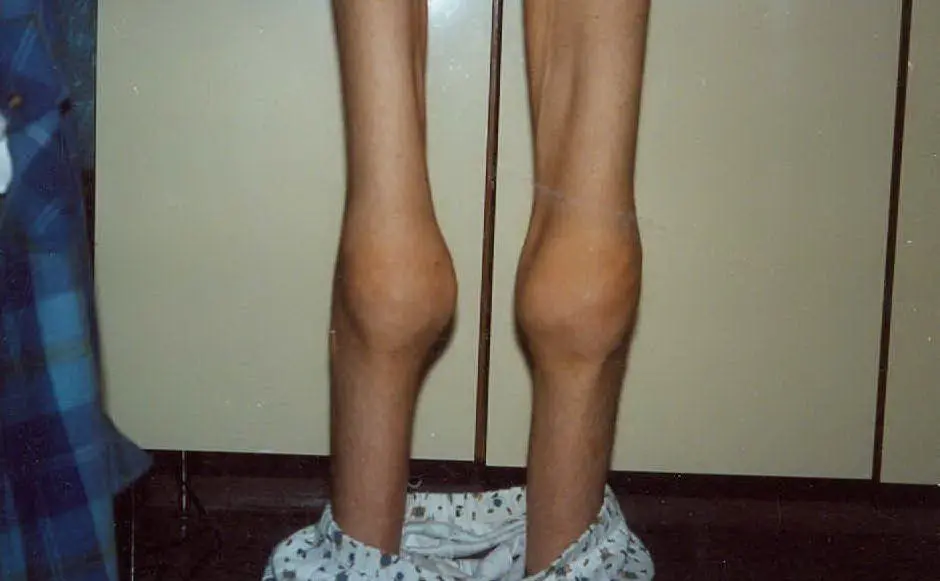 Uno scatto delle gambe della giovane