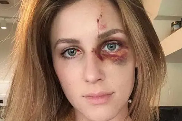 Melissa Gentz (foto Instagram)