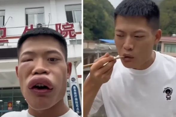 Influencer cinese mangia una vespa viva (frame dai social)
