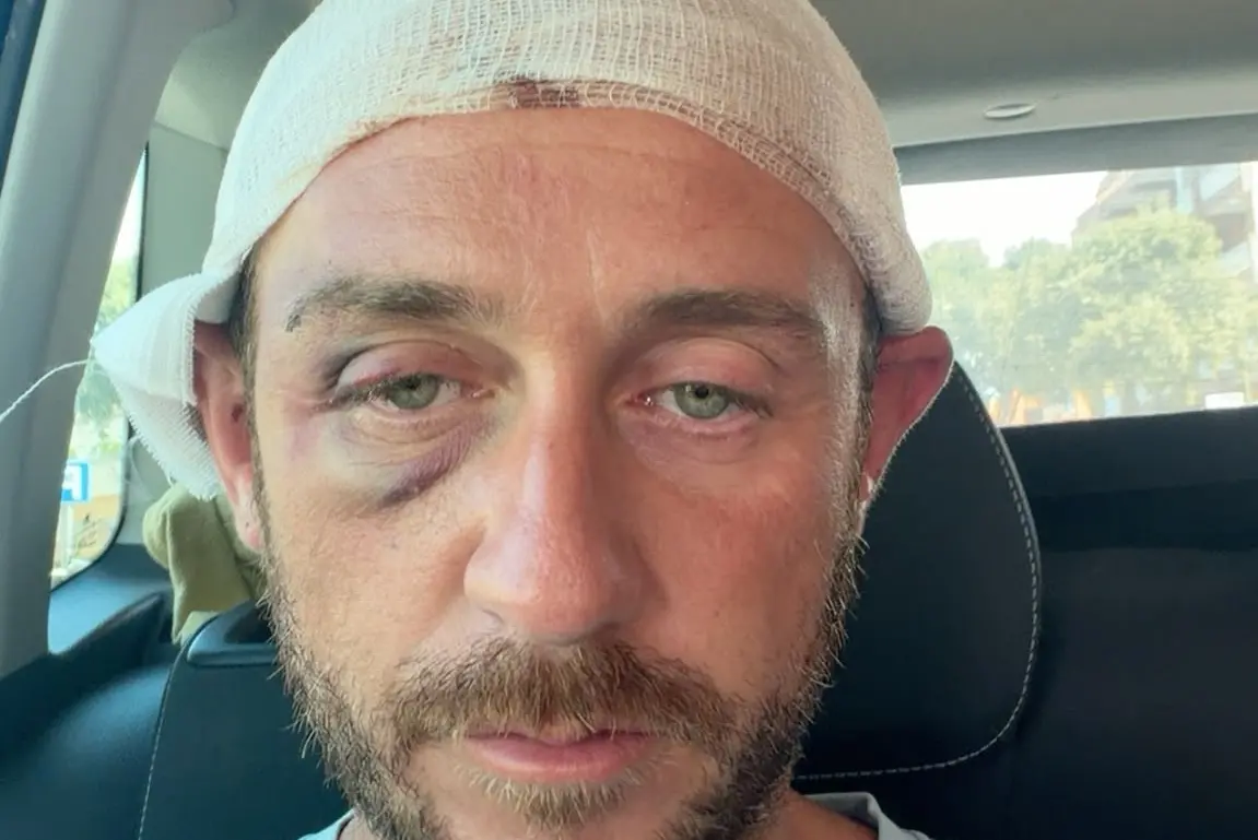 Angelo Ratti dopo l'aggressione