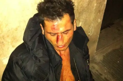 Berat Racaj dopo l'aggressione di Adrian Mutu