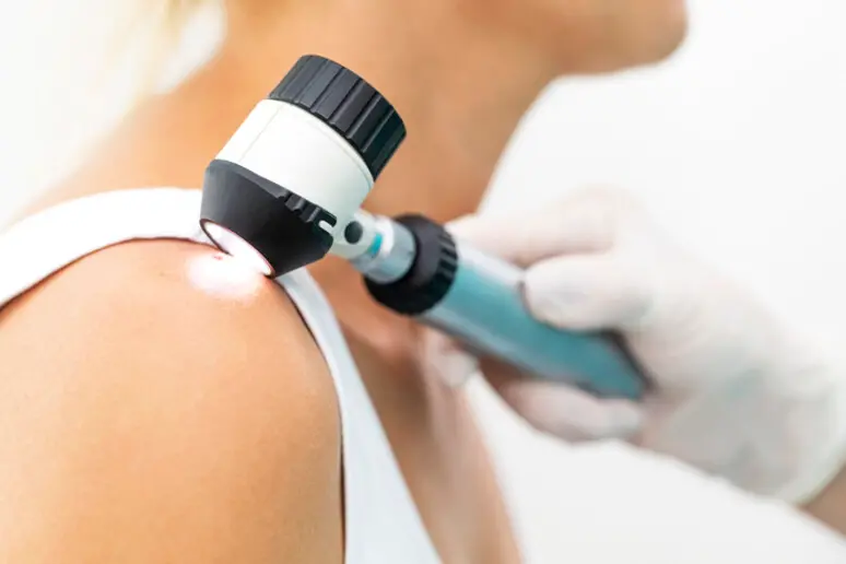Visita dermatologica (foto Ansa)