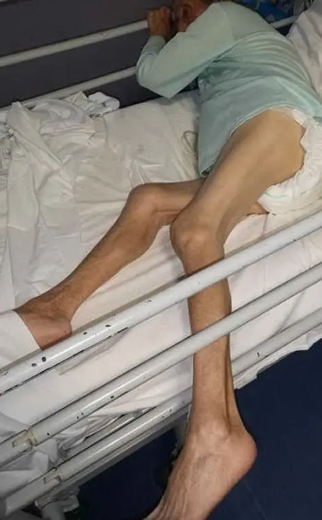 La donna con la gamba incastrata tra le sbarre del letto (foto Facebook)