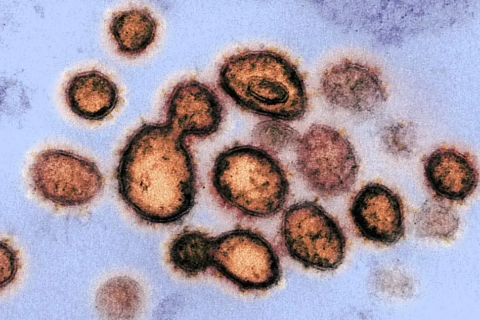 (Il virus della Sars in un'immagine del National Institute of Health)