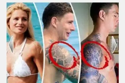 Il braccio del bodyguard com'era prima e come è adesso