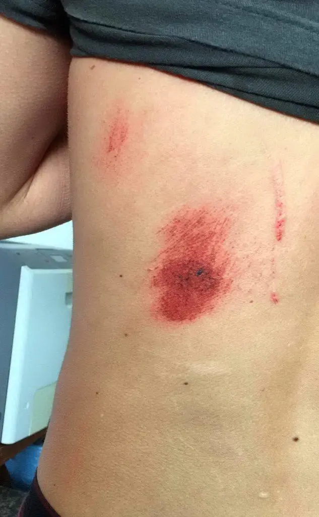 Il ragazzo malmenato