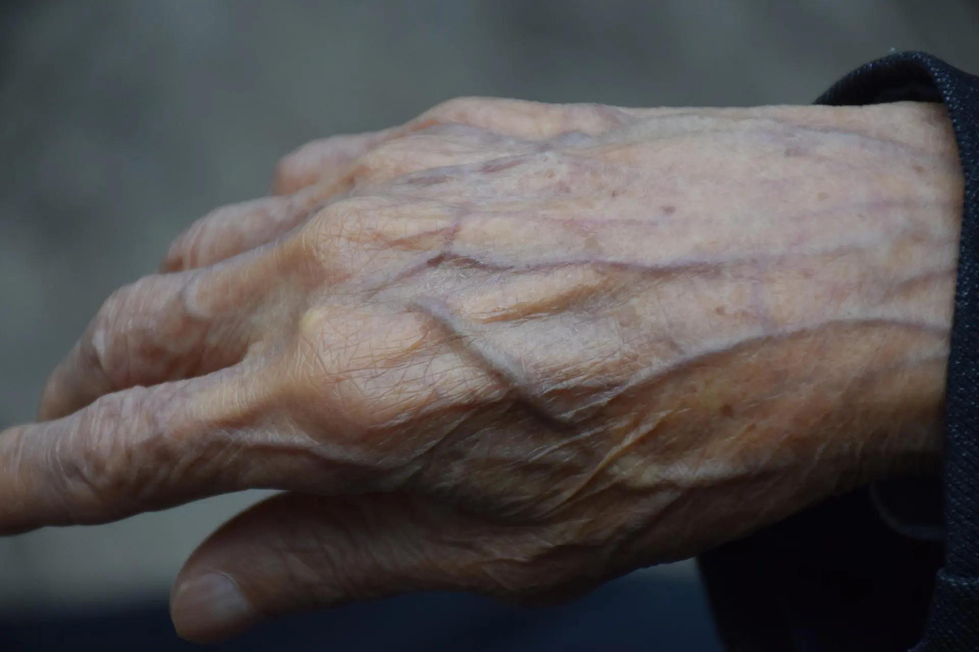 "Mio zio, malato di Alzheimer, lasciato solo e nudo in ospedale a Sassari" (foto simbolo www.pixabay.com)