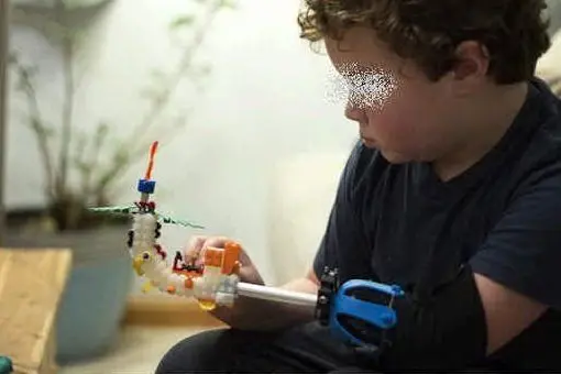 Aidan e la sua protesi di Lego
