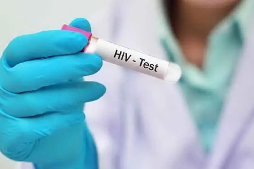 Il test dell'Hiv (foto da Google)