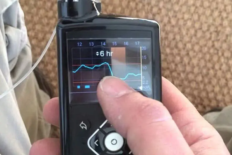 Uno strumento per la microinfusione (foto @Medtronic)