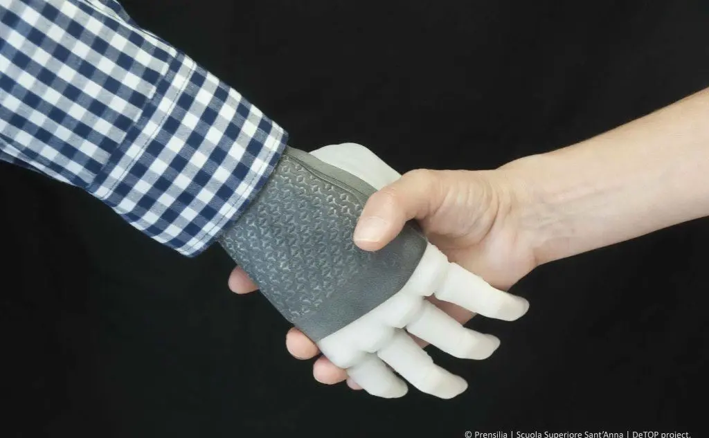 Per la prima volta una mano robotica è stata impiantata ad una donna