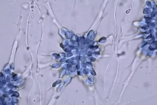Tumori pediatrici, farmaco made in Italy di Biogenera lancia sfida