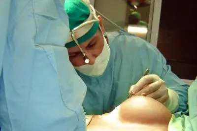 Un'operazioine di chirurgia estetica