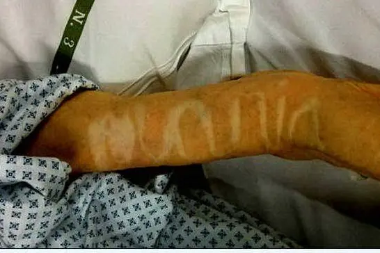 La scritta apparsa sul braccio della suora (foto Il Gazzettino)