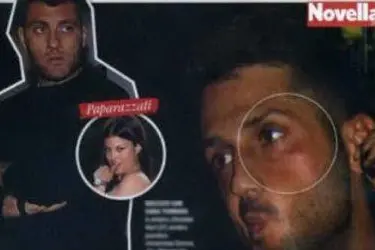 Novella 2000 mostra la foto di Fabrizio Corona con un occhio nero dopo la rissa con Bobo Vieri (Novella 2000)