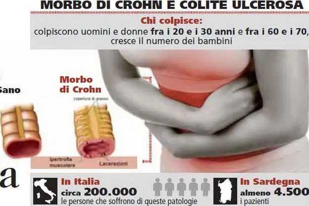 Il morbo di Crohn
