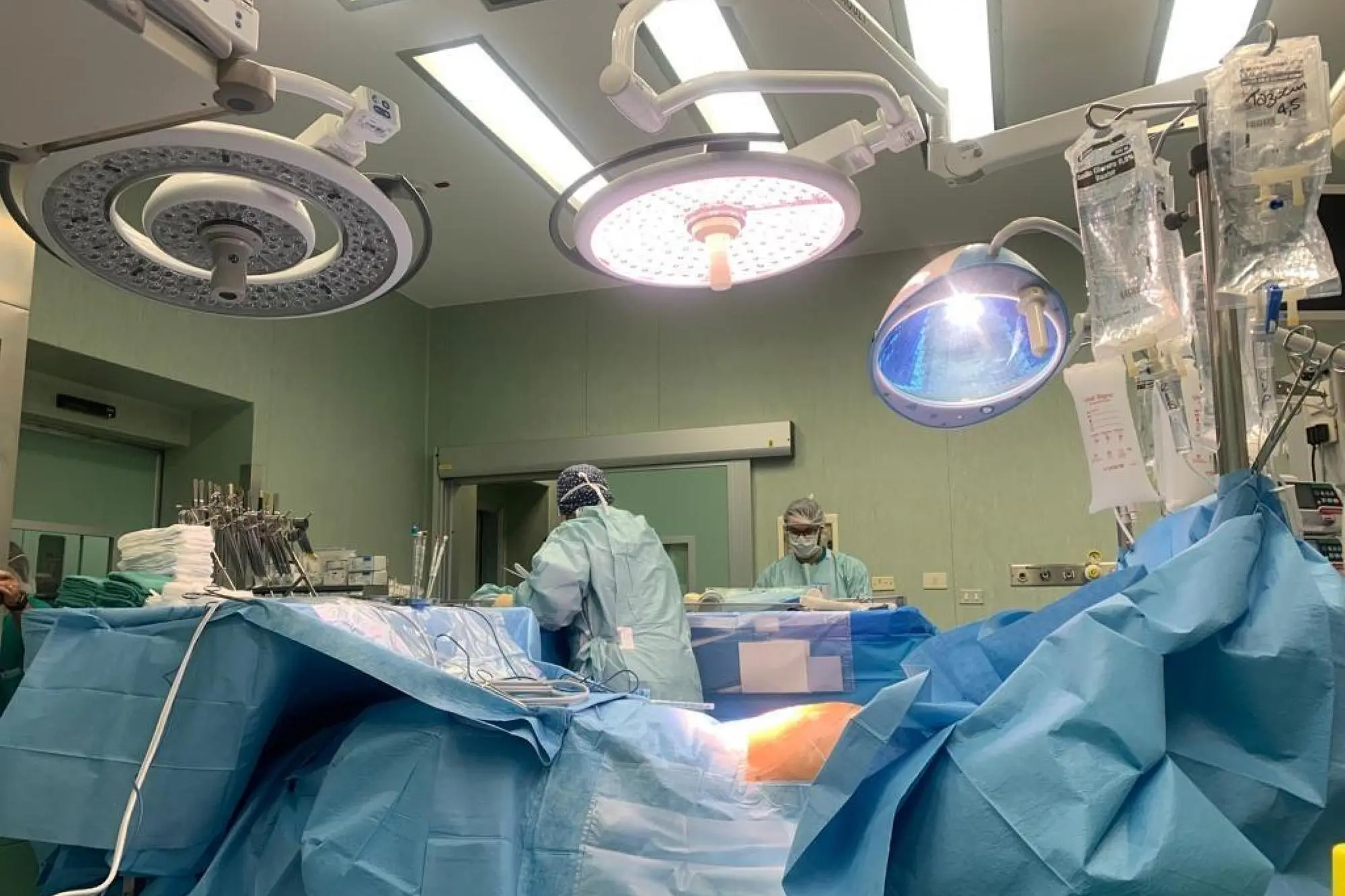 L'equipe del direttore del Centro trapianto di fegato e neo-direttore del dipartimento Trapianti della Città della salute di Torino, Renato Romagnoli, in sala operatoria per salvare una donna di 26 anni con un trapianto di fegato in super-urgenza all'ospedale Molinette della Città della salute di Torino. La giovane, della zona di Alba (Cuneo), è stata colta da malore dpo un colpo di calore vicino alla sua casa di campagna. Trovata incosciente dai familiari sotto un albero, è stata portata in urgenza all'ospedale di Verduno l'ospedale di Verduno (Cuneo) e aveva una temperatura interna di 41 gradi. Stabilizzate le funzioni vitali, si è presentata però un'insufficienza epatica fulminante, che ha reso necessario il trapianto, 6 agosto 2024 ANSA/ Città della Salute Torino ANSA PROVIDES ACCESS TO THIS HANDOUT PHOTO TO BE USED SOLELY TO ILLUSTRATE NEWS REPORTING OR COMMENTARY ON THE FACTS OR EVENTS DEPICTED IN THIS IMAGE; NO ARCHIVING; NO LICENSING NPK