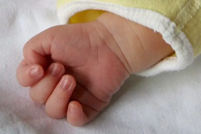 Dettaglio mano di una bambina (Foto simbolo)