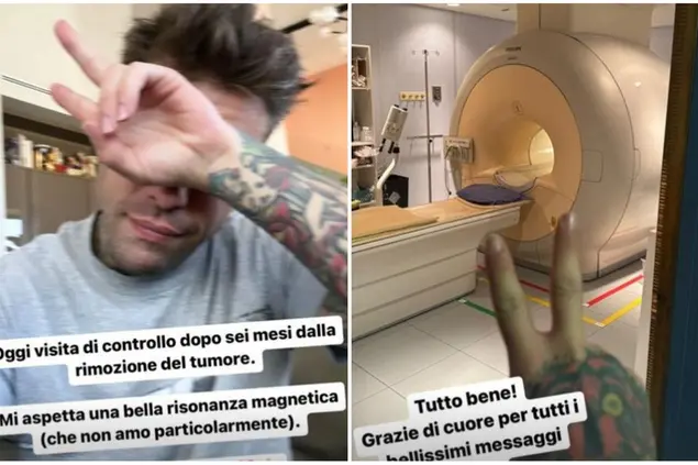 Fedez, visita di controllo dopo il tumore al pancreas: “È andato tutto bene” (foto da Instagram)