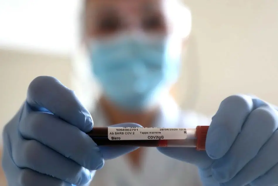 Coronavirus (Ansa)