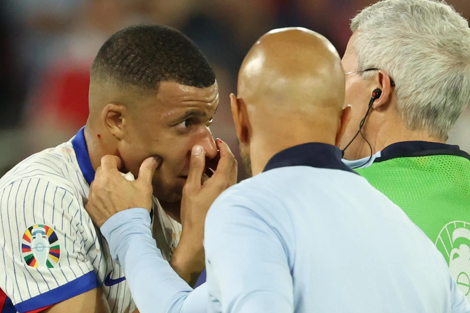 epa11418971 Kylian Mbappe of France gets medical treatment during the UEFA EURO 2024 group D soccer match between Austria and France, in Dusseldorf, Germany, 17 June 2024. EPA/FRIEDEMANN VOGEL