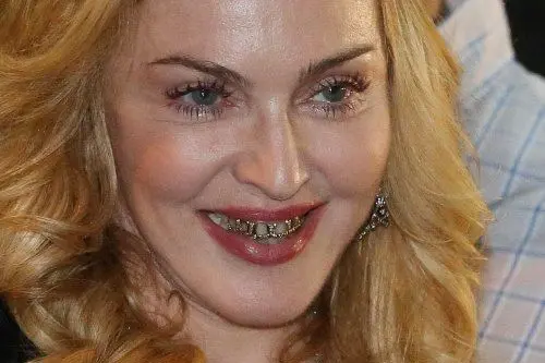 Madonna a Roma, in primo piano l'apparecchio d'oro e diamanti