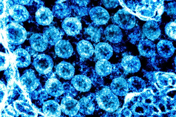 Particelle di coronavirus viste al microscopio (fonte NIAID via Ansa)