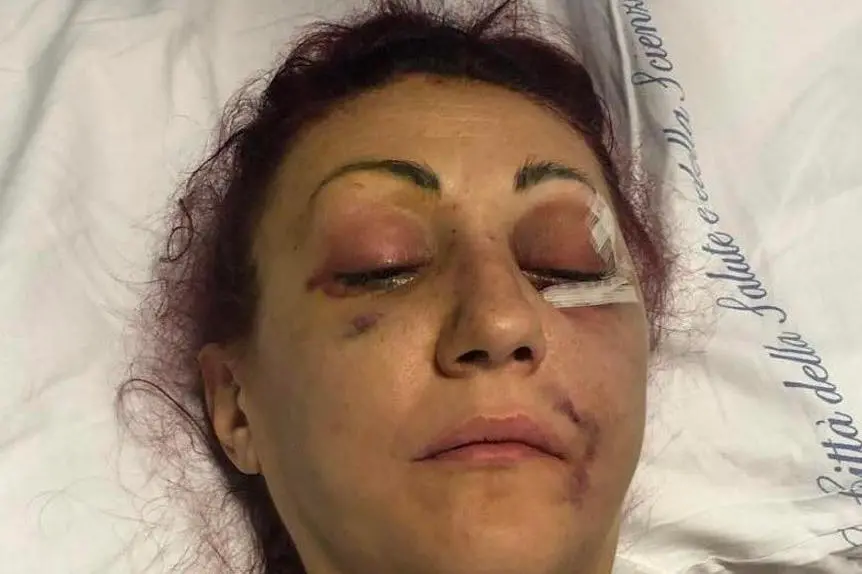 Lucia Regna dopo l'aggressione