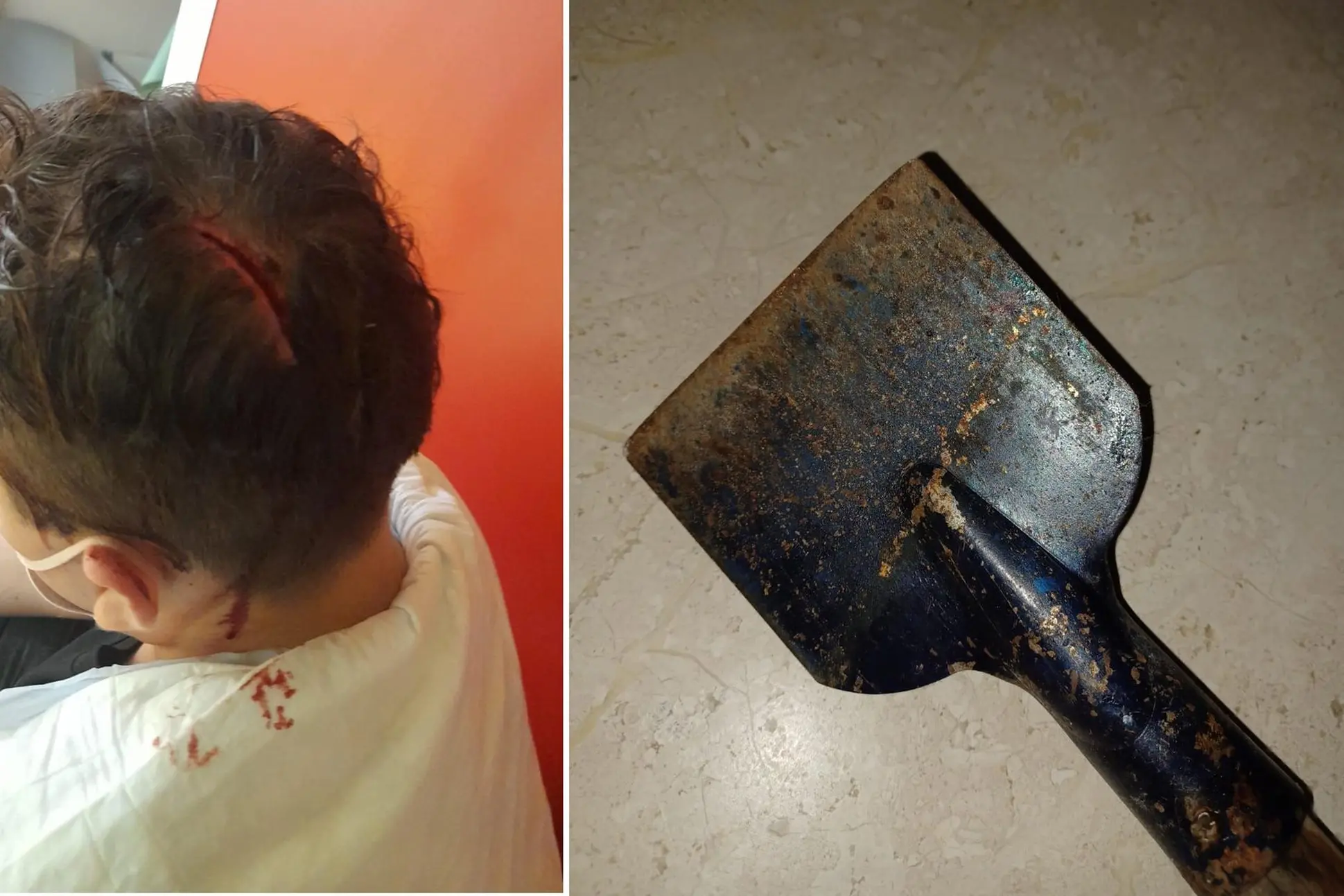 La ferita alla testa e la pala usata per l'aggressione (L'Unione Sarda)