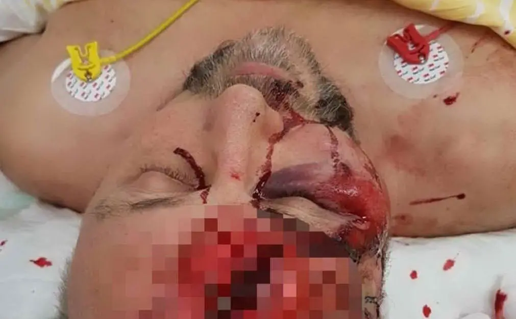 L'uomo ferito (foto Fb Afd)