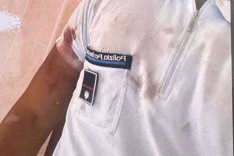 Agente ferito a Bancali