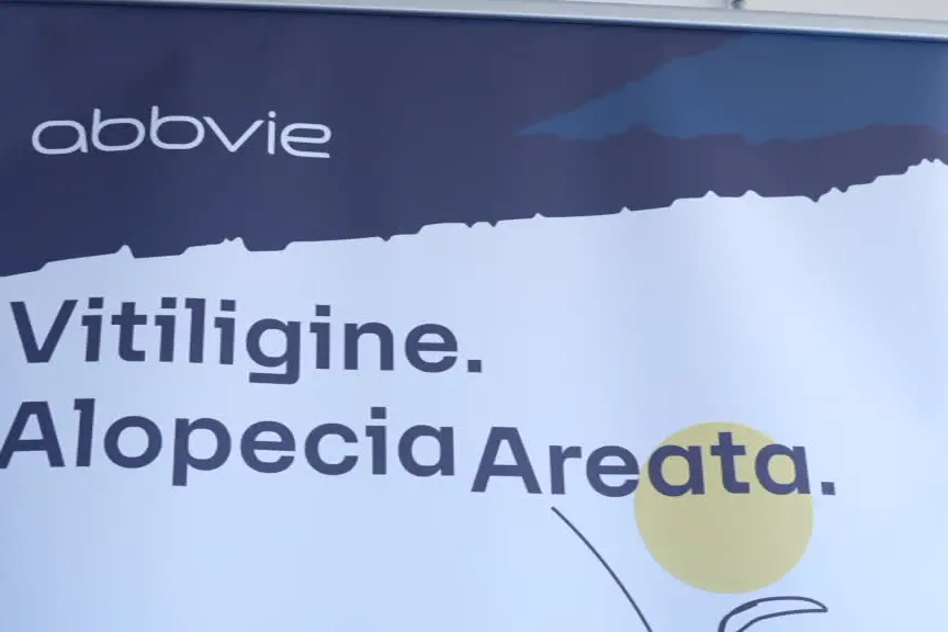 Vitiligine e alopecia, nuove cure oltre lo stigma