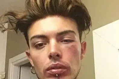 Il cantante dei The Kolors si sfoga su Instagram