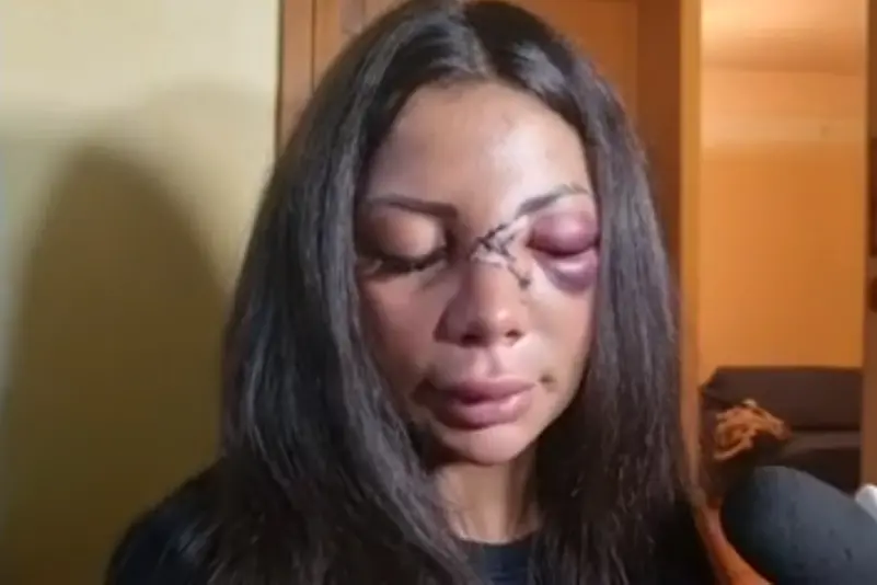 La ragazza dopo l'aggressione (frame da video Il Tirreno)