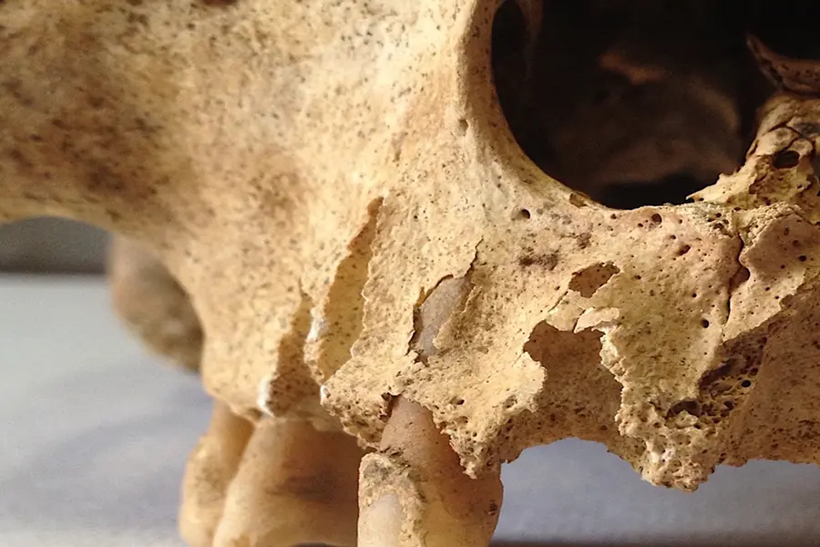 Pezzo di cranio, risalente al 1800, di un individuo maschio di 46 anni circa (foto concessa)