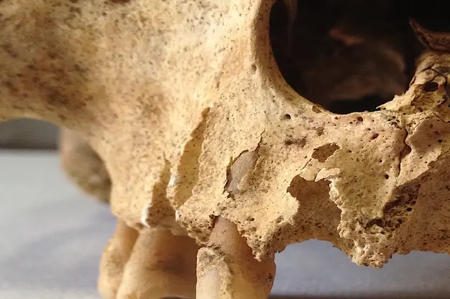 Pezzo di cranio, risalente al 1800,\u00A0di un individuo maschio di 46 anni circa (foto concessa)