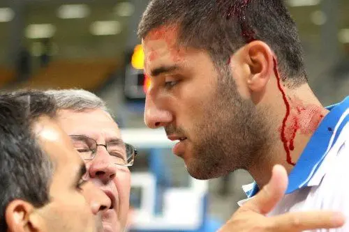 Sangue dopo le rissa