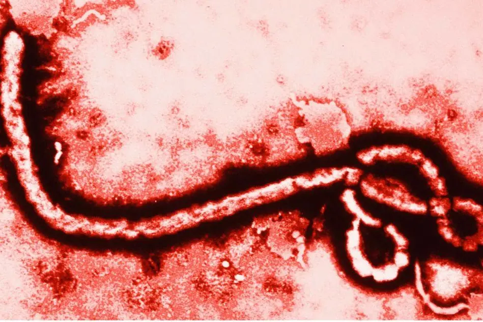 Il virsu dell'Ebola al microscopio