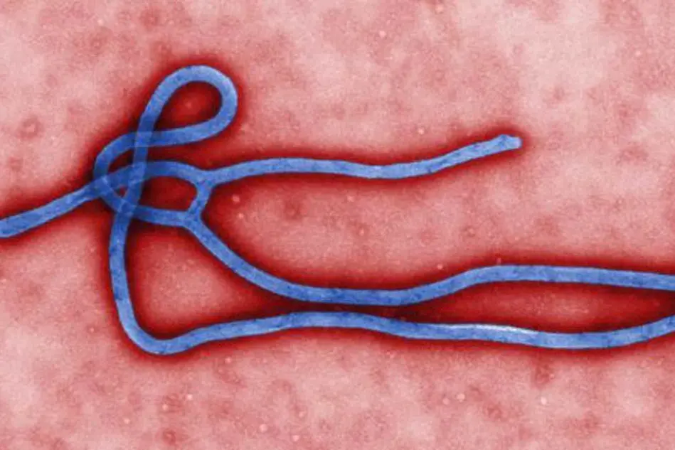 Il virus dell'Ebola