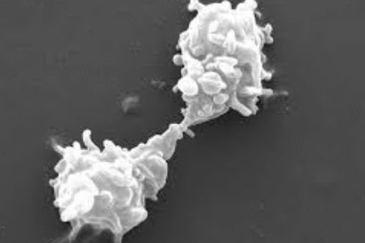 Un'immagine al microscopio del temibile ameba