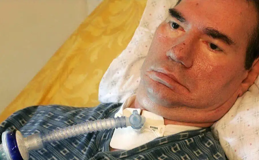 L'allora 61enne era gravemente malato di distrofia muscolare