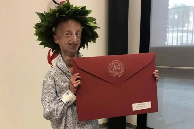 Sammy Basso nel giorno della laurea (foto Ansa)