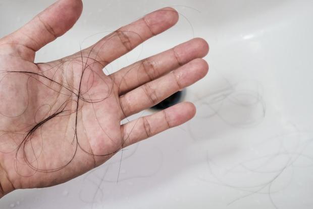 Covid e perdita di capelli (foto Ansa)