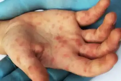 Influenza del pomodoro, attenzione massima (foto Ansa)