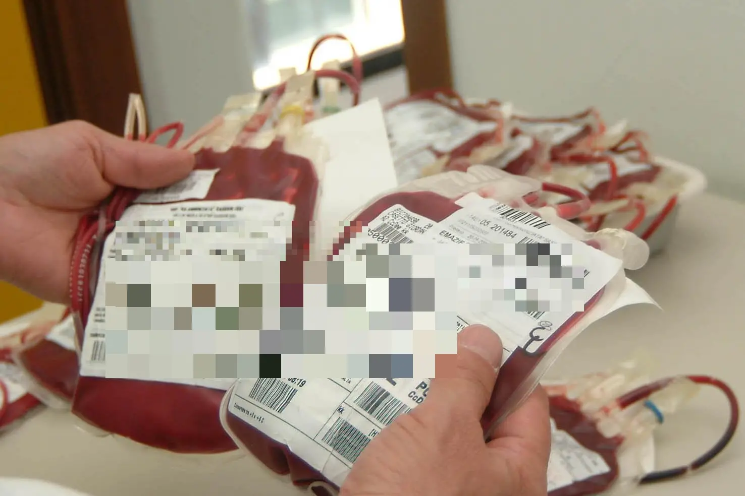Sacche per la trasfusione di sangue (archivio L'Unione Sarda - @Calvi)